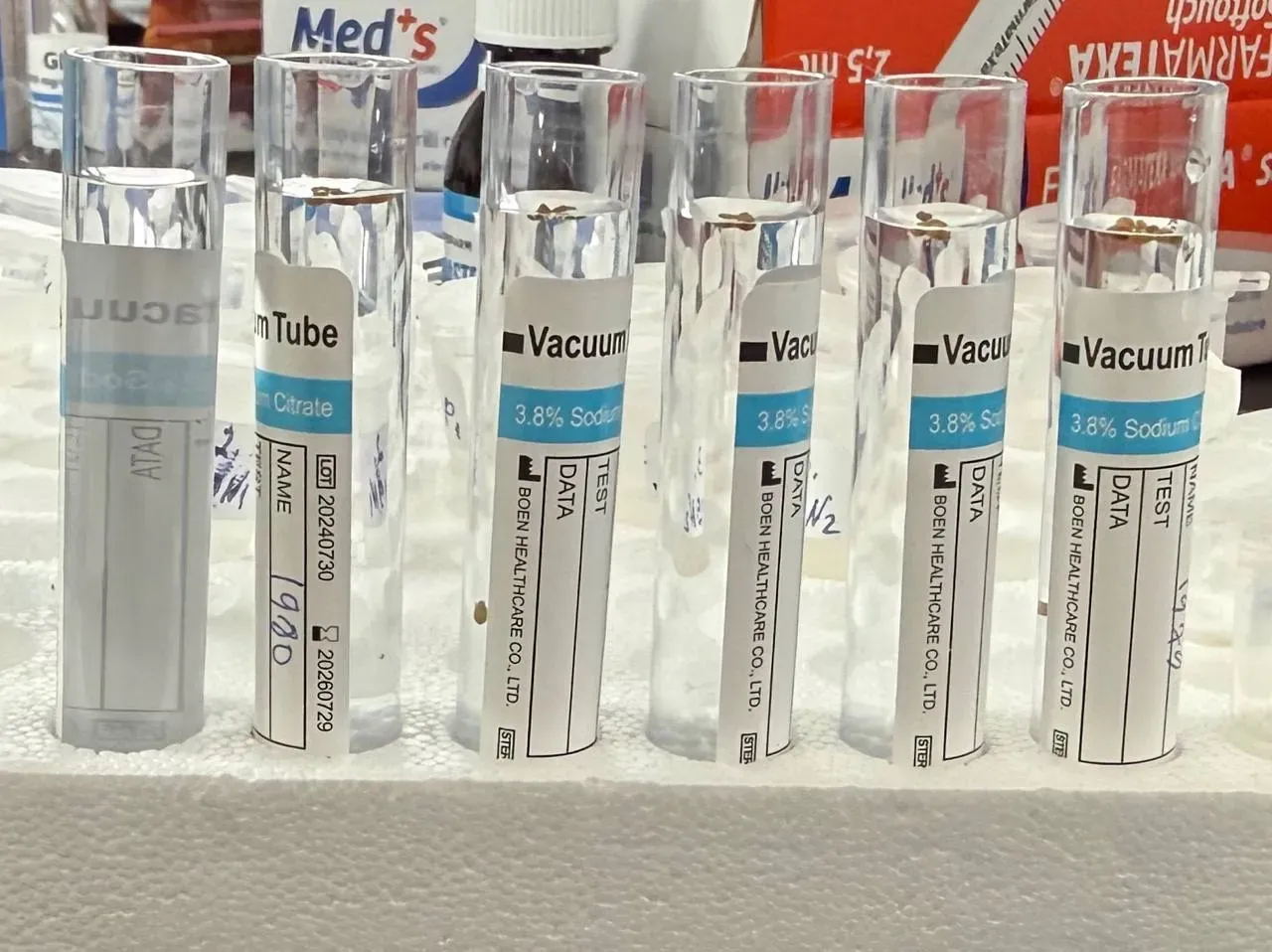 Plant growth monitoring