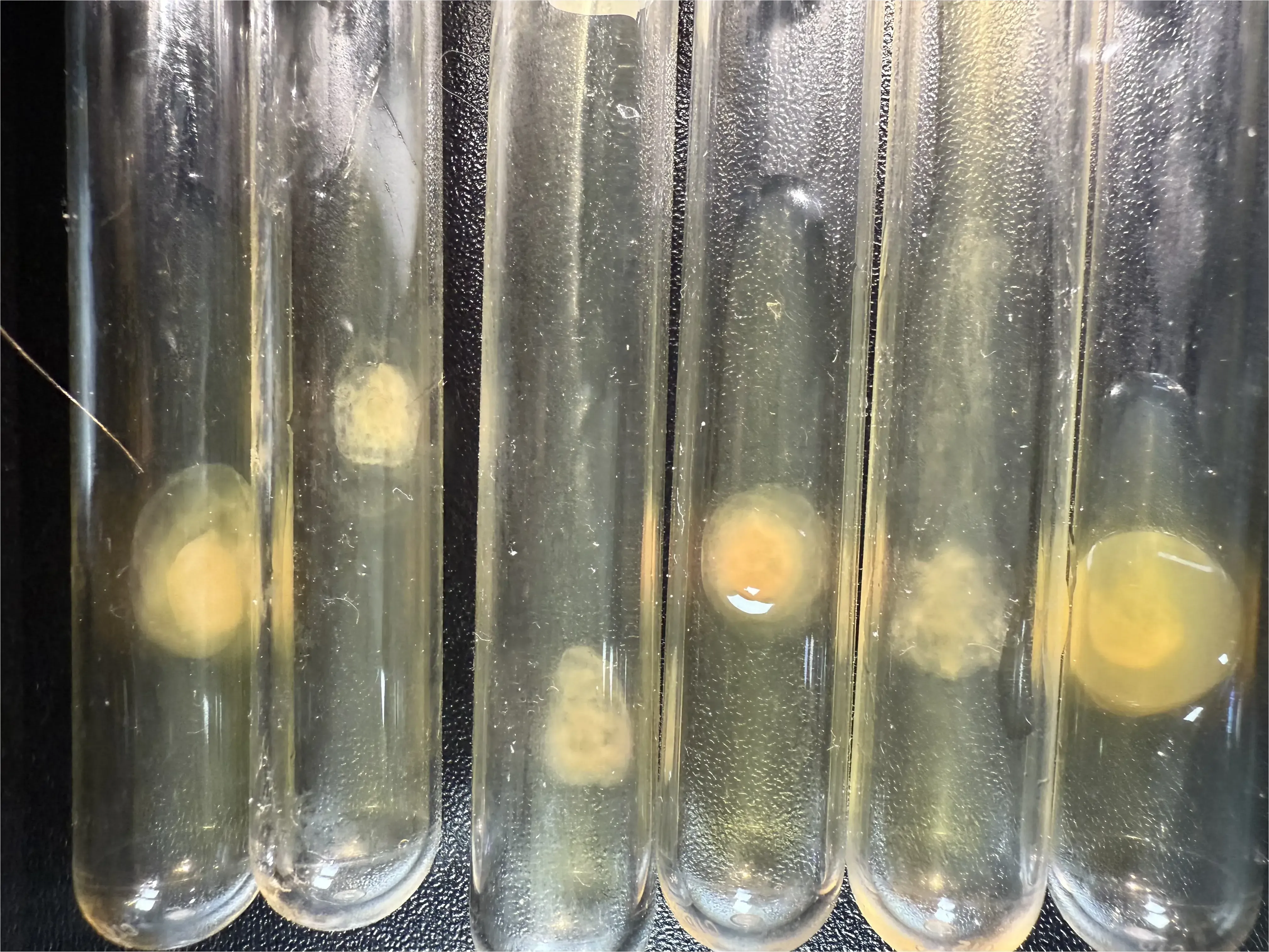 Hyperbolic Field Blood Plasma Study