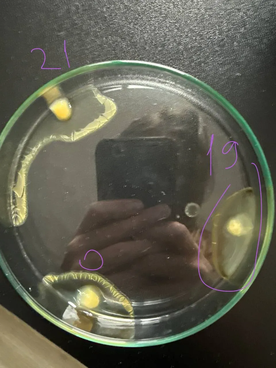 Blood plasma flask sample