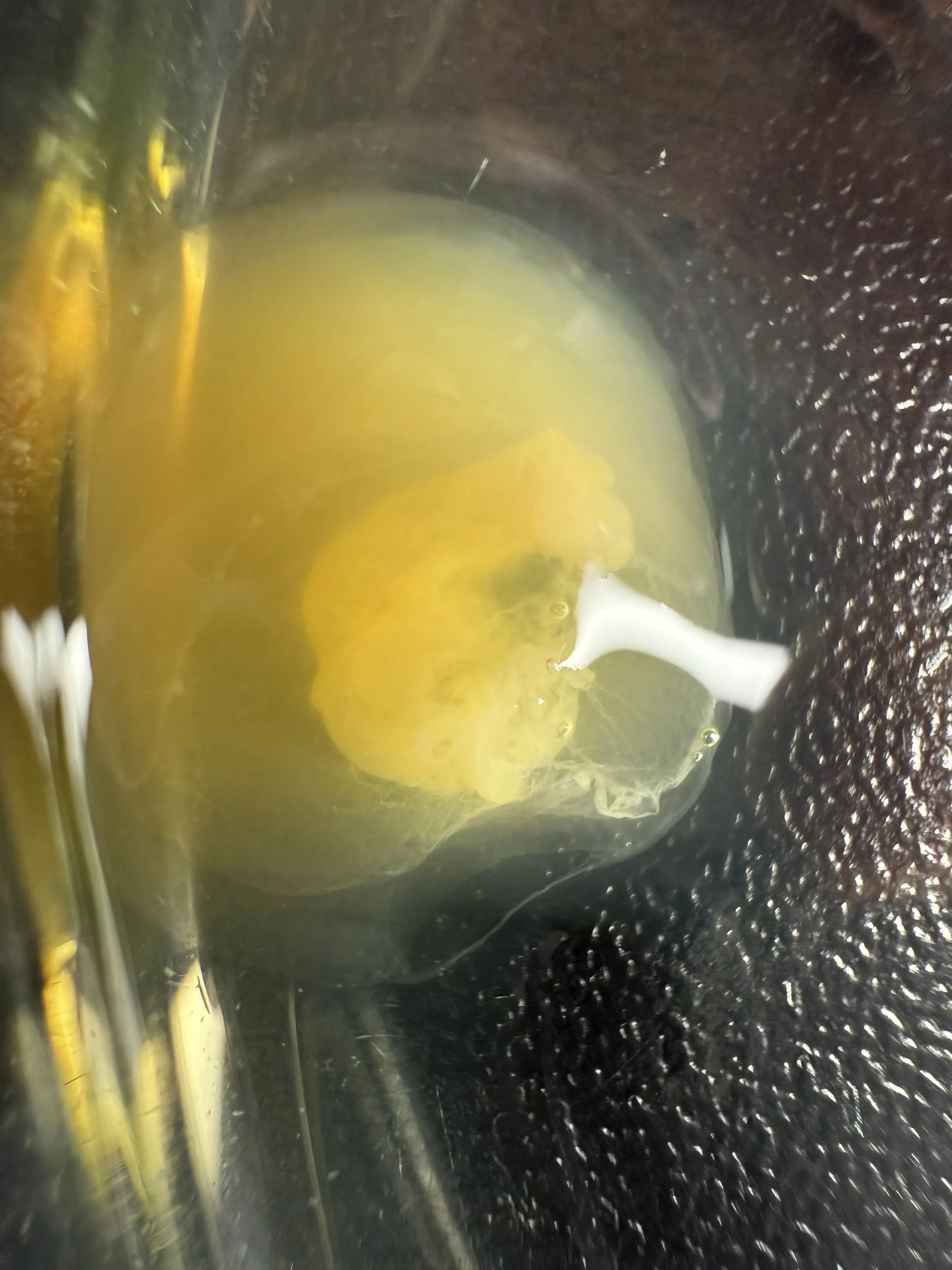 Coagulation progression