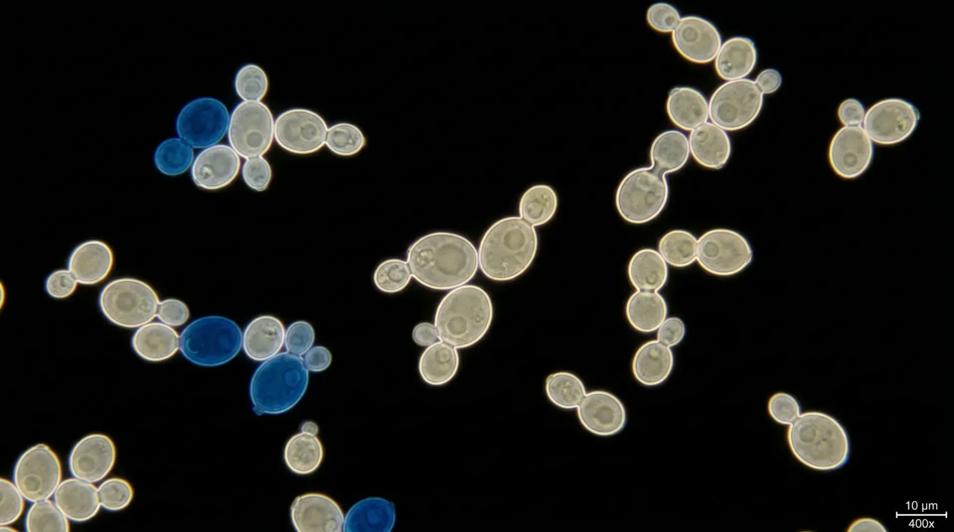 Hyperbolic Field Saccharomyces Cerevisiae Study