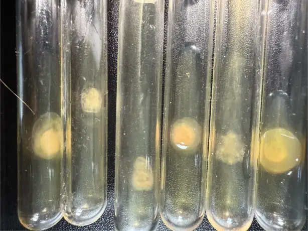Hyperbolic Field Blood Plasma Study